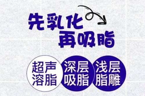 超脂塑體雕 超脂塑體雕