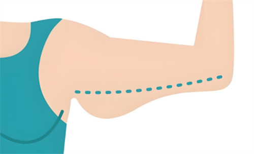 吸脂瘦手臂對(duì)比動(dòng)畫