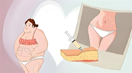 抽脂手術(shù)前后對(duì)比動(dòng)畫圖