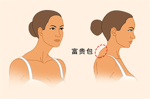 富貴包動畫展示圖 富貴包動畫展示圖