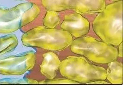 水動力吸脂微觀示意圖 水動力吸脂微觀示意圖