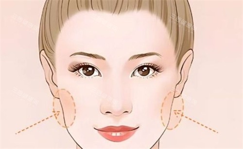 面部?jī)蓚?cè)凹陷 面部?jī)蓚?cè)凹陷