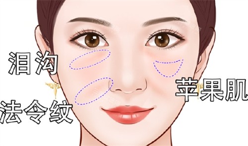 面部凹陷之后所呈現(xiàn)的面部狀態(tài) 面部凹陷之后所呈現(xiàn)的面部狀態(tài)