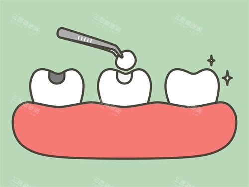 補(bǔ)牙漫畫圖示意圖