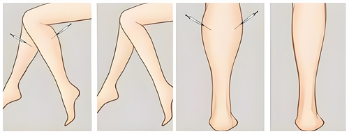 腿部吸脂手術(shù)前后對(duì)比動(dòng)畫圖