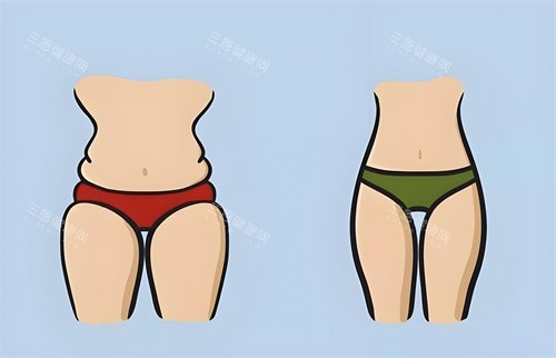 腿部吸脂手術(shù)前后對(duì)比正面動(dòng)畫圖