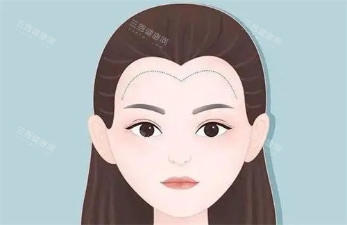 植發(fā)際線卡通 植發(fā)際線卡通