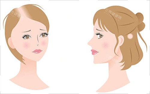 各種脫發(fā)素材