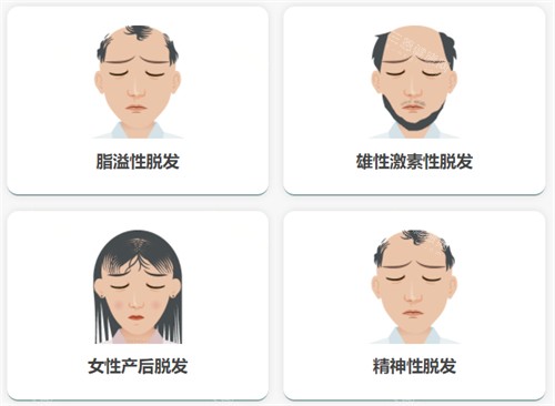 不同脫發(fā)類(lèi)型