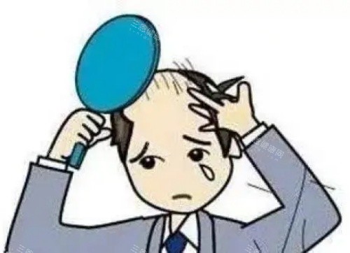 頭發(fā)禿頂示意圖