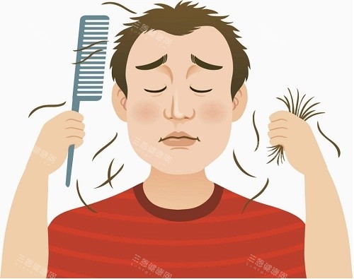 脫發(fā)示意圖