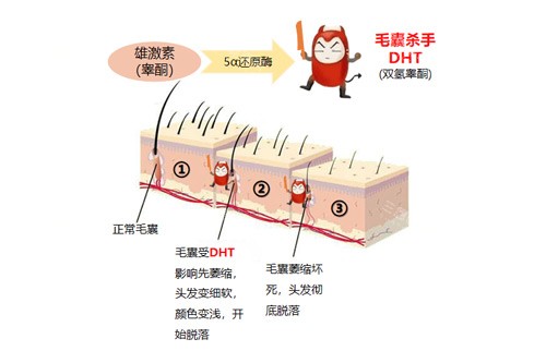毛發(fā)缺少原因圖