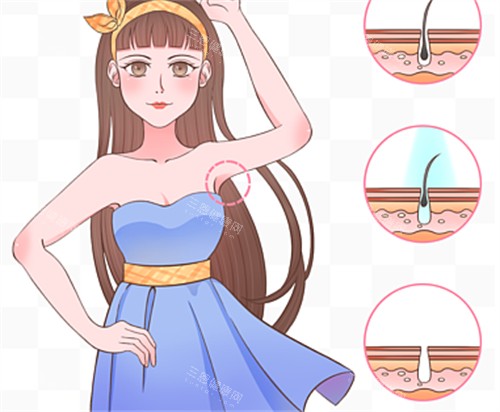 腋下脫毛前后毛囊對比圖