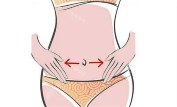 腹壁成形術(shù)2