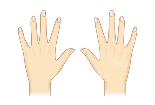 手背拉皮術(shù)后示意圖
