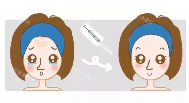 眼部注射前后對比圖