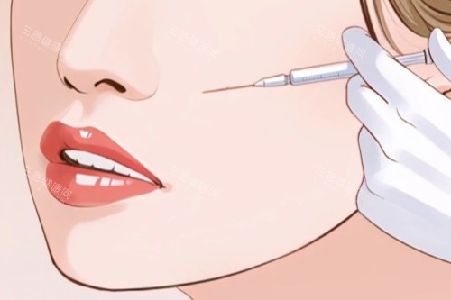 面部注射卡通一覽