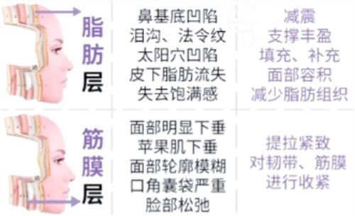 筋膜層抗衰重點(diǎn)