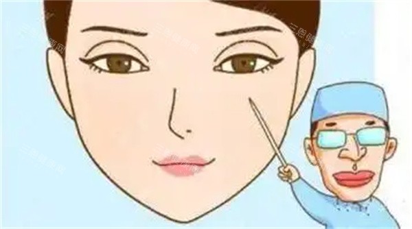 雙眼皮疤痕修復手術(shù)