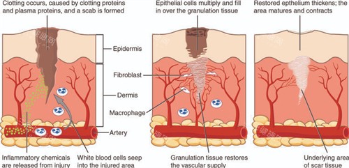 改善皮膚色素疤痕 改善皮膚色素疤痕