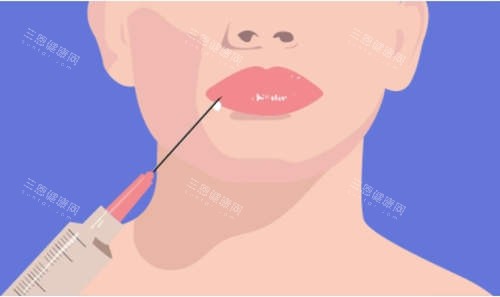 注射美容卡通圖 注射美容卡通圖