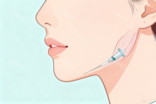 臉部注射美容卡通圖 臉部注射美容卡通圖