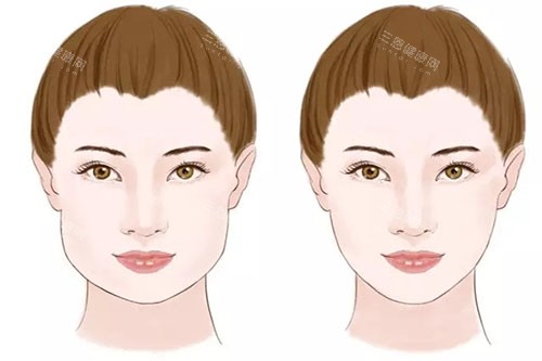 瘦臉卡通對比圖