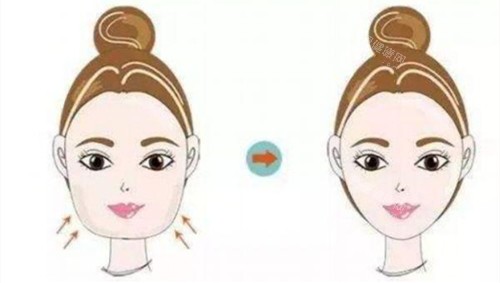 瘦臉**對比動畫圖