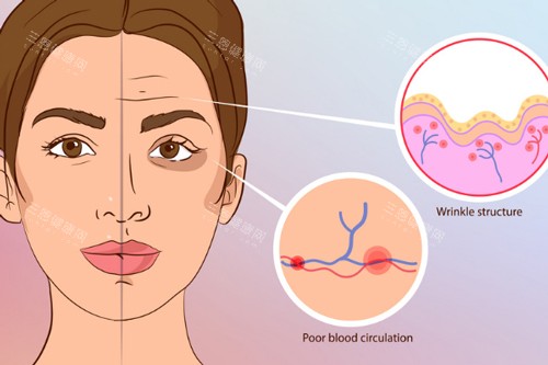 注射玻尿酸前后對(duì)比