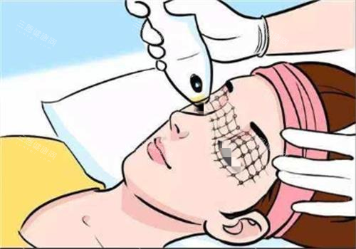 光子嫩膚過(guò)程圖