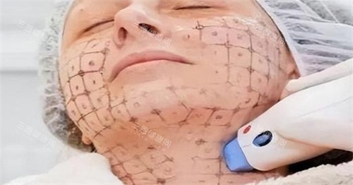 熱瑪吉中下面部設(shè)計點位圖