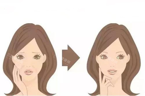 面部注射卡通對比圖